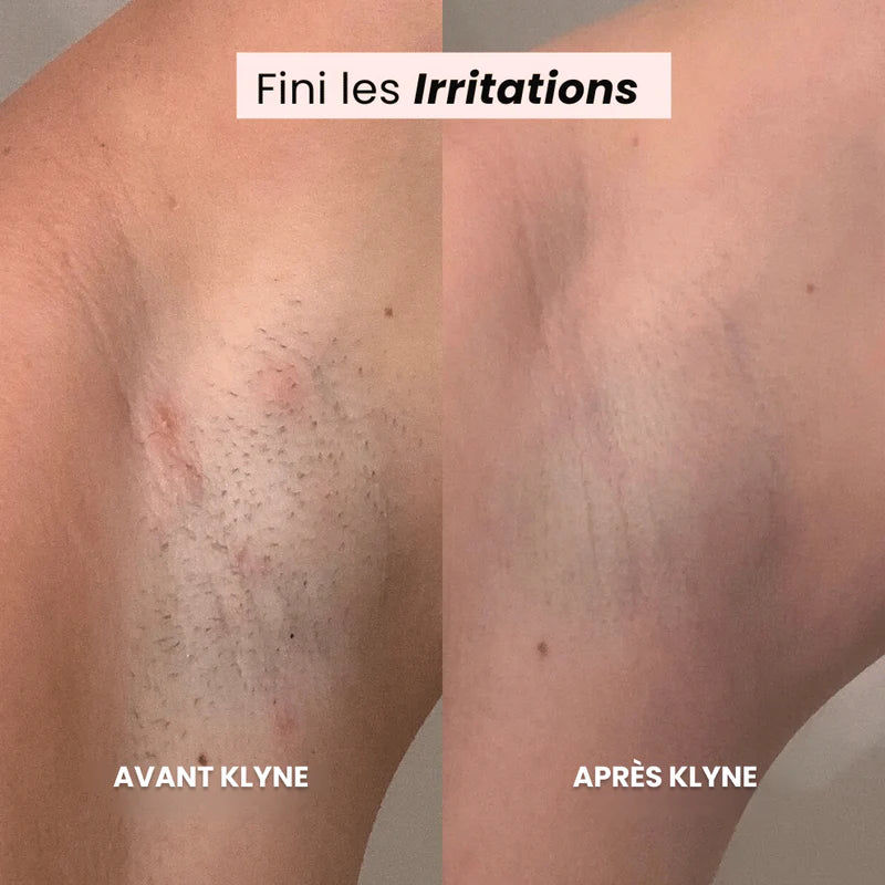 Rasoir SOFT®